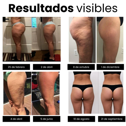 Leggings anticelulíticos Lunaya®